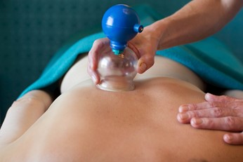 Cupping massage Groningen